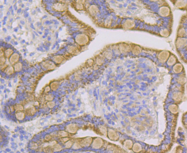 Anti-CYP27A1 Antibody (5U325)
