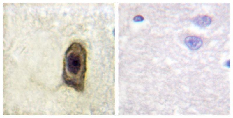 Anti-Phospho-CSF1R (Tyr561) Polyclonal Antibody