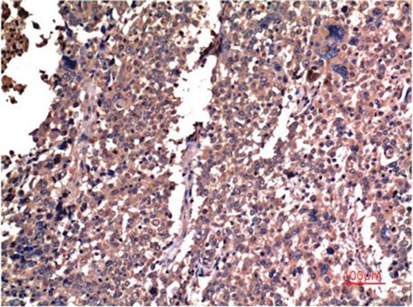 Anti-CCNB1 Antibody (6K114)