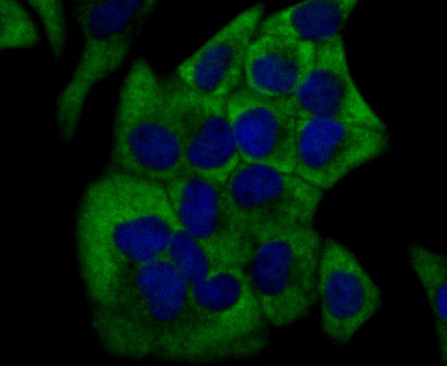 Anti-CYP17A1 Antibody (1U433)