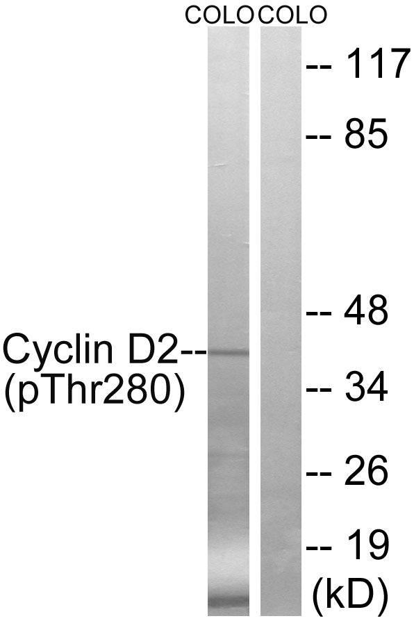 Anti-Phospho-CCND2 (Thr280) Polyclonal Antibody