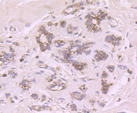 Anti-CYP17A1 Antibody (1U433)