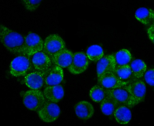 Anti-CRMP1 Antibody (1I169)