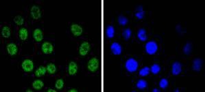 Anti-CCNE1 Antibody (7P753)