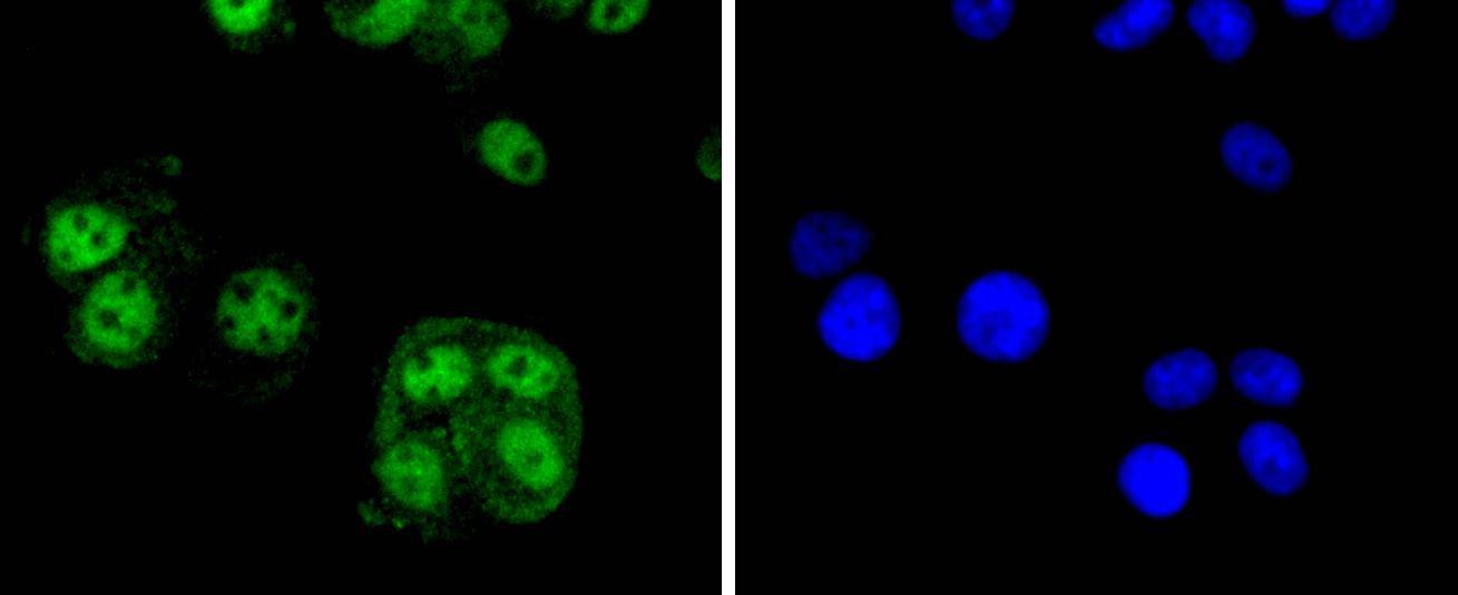 Anti-Cyclin E2 Antibody (2N277)