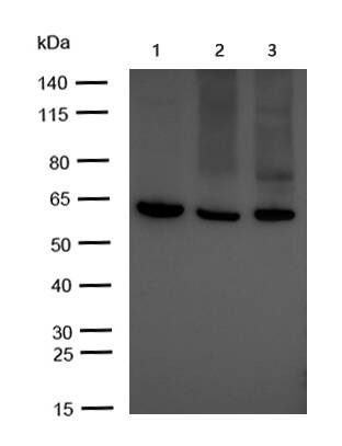 Anti-CYP27A1 Antibody (5U325)