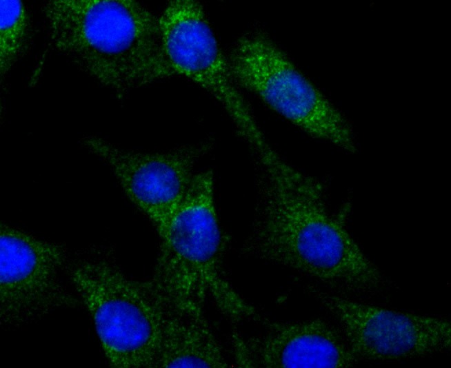 Anti-CRMP1 Antibody (1I169)