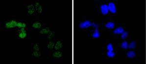 Anti-CCNE1 Antibody (7P753)
