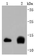 Anti-CST3 Antibody (6K312)