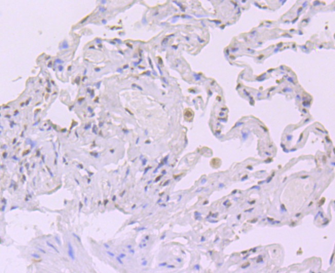 Anti-XPO1 Antibody (2H608)