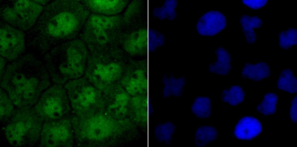 Anti-XPO1 Antibody (2H608)
