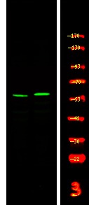 Anti-Phospho-CSK (Tyr304) Polyclonal Antibody