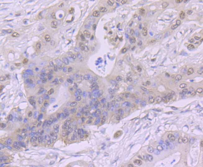 Anti-CSNK2B Antibody (8H798)