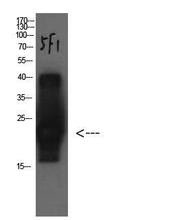 Anti-CST3 Antibody (4F224)