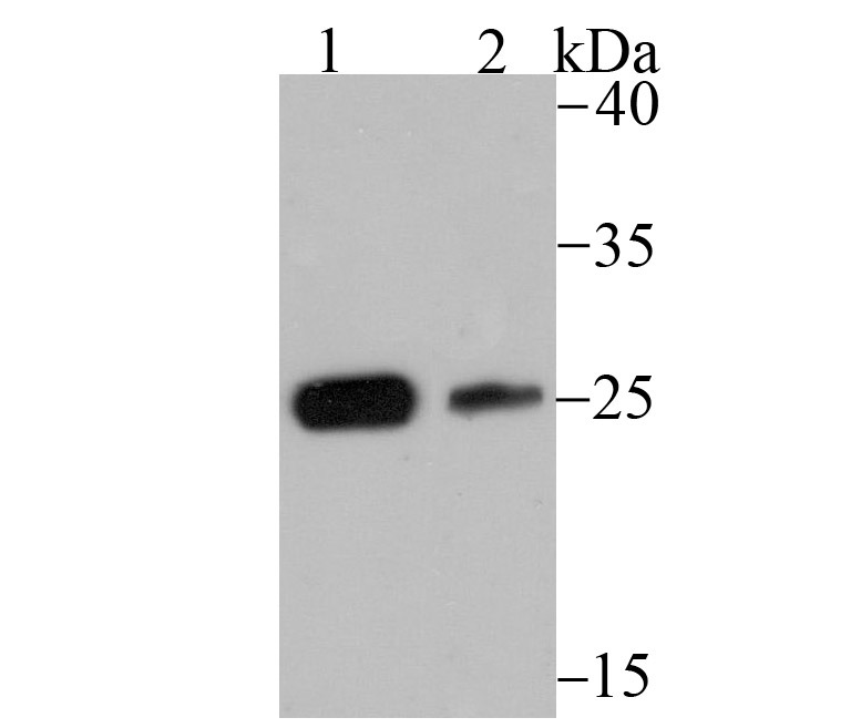 Anti-CSNK2B Antibody (8H798)