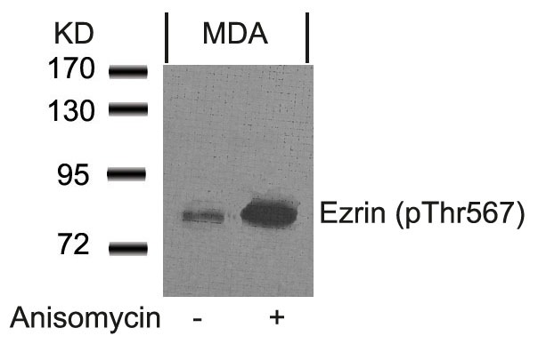 Anti-Phospho-Ezrin (Thr567) Polyclonal Antibody