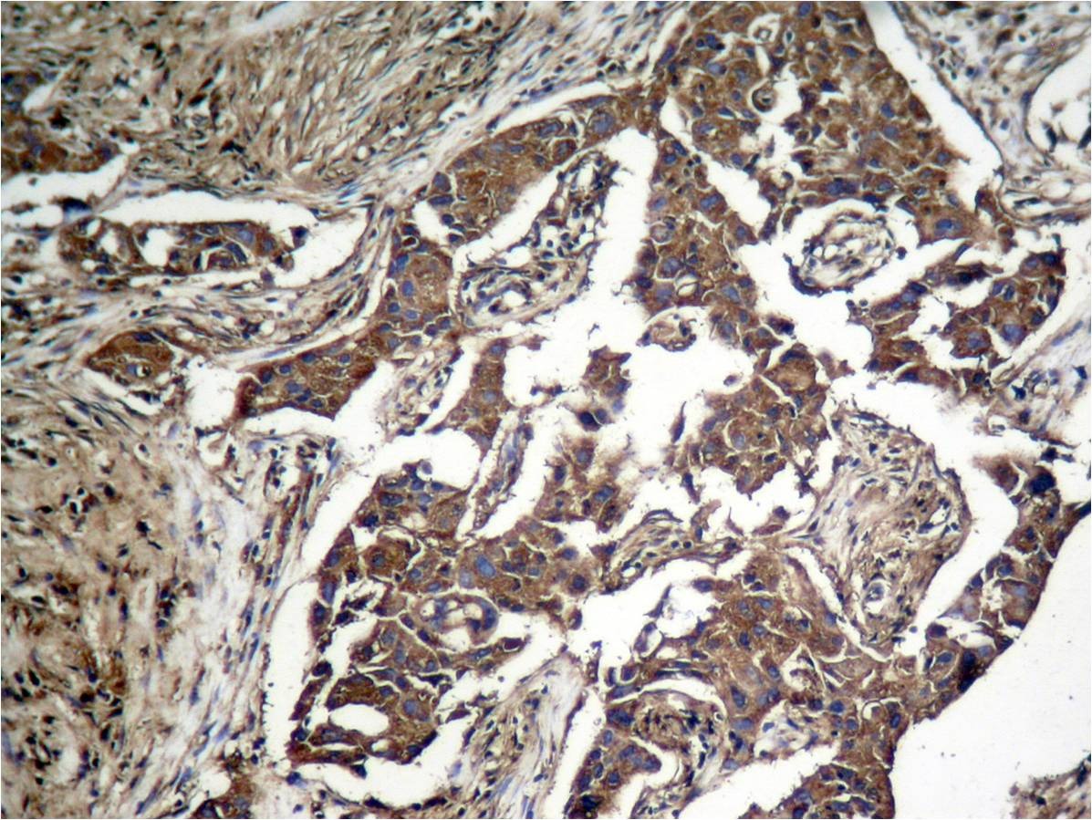 Anti-Phospho-EIF2S1 (Ser51) Polyclonal Antibody 2