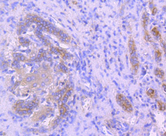 Anti-Ezrin Antibody (7A973)