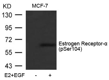 Anti-Phospho-ER alpha (Ser104) Polyclonal Antibody