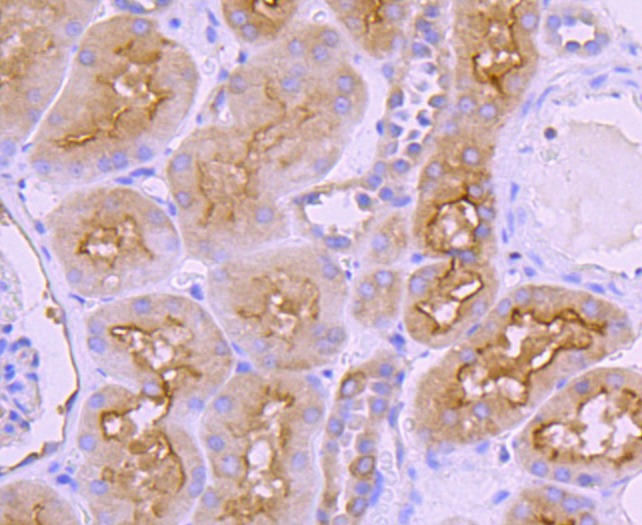 Anti-Ezrin Antibody (7A973)