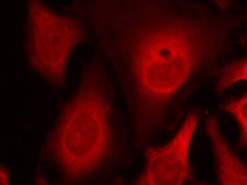 Anti-Phospho-EIF2S1 (Ser49) Polyclonal Antibody