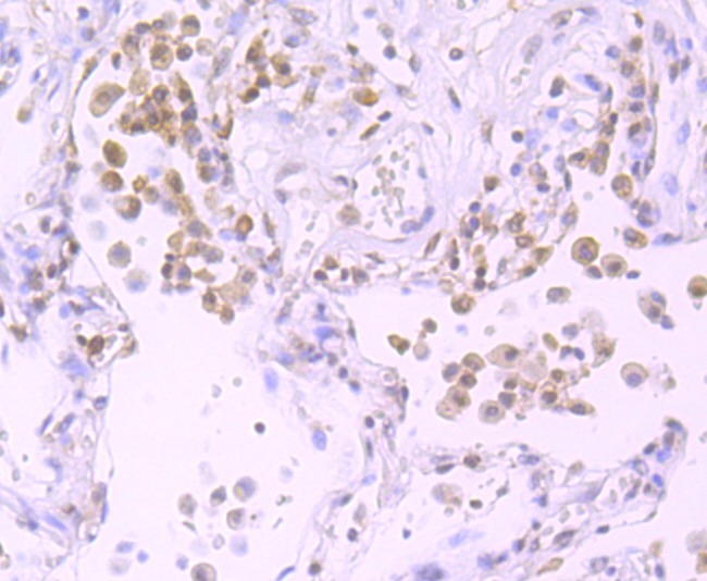Anti-Exportin-5 Antibody (6J749)
