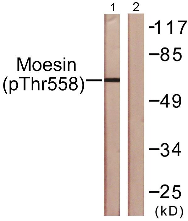Anti-Phospho-Ezrin/Radixin/Moesin (Thr567/564/558) Polyclonal Antibody