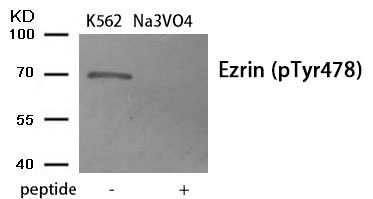 Anti-Phospho-Ezrin (Tyr478) Polyclonal Antibody