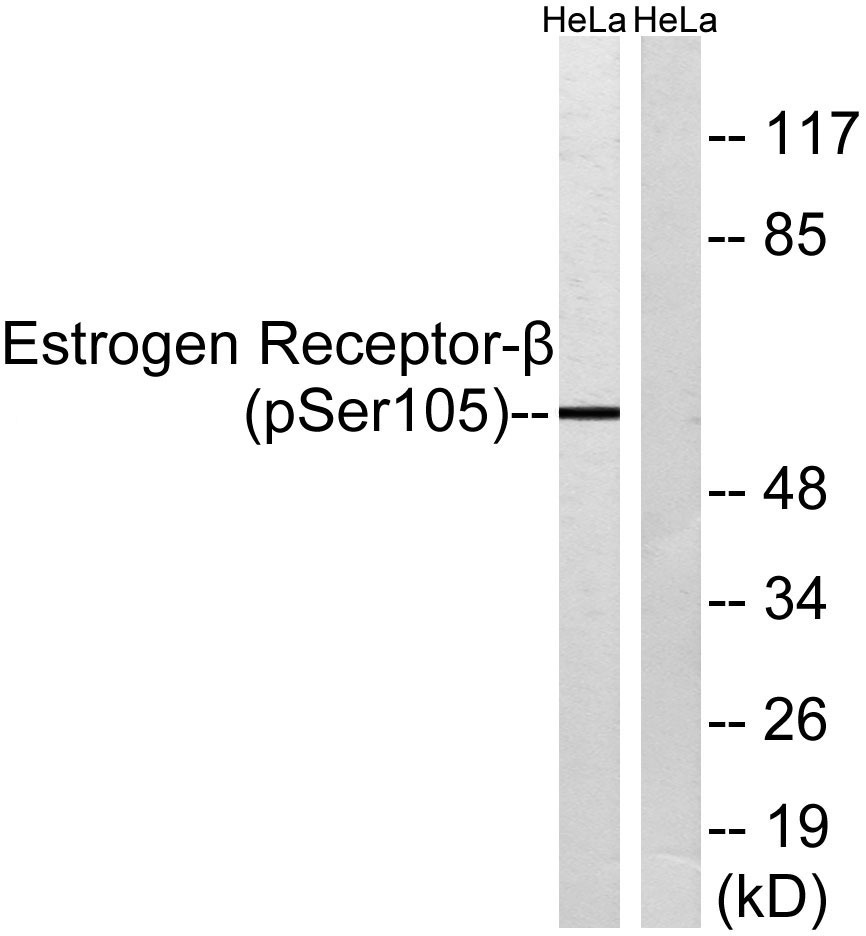 Anti-Phospho-ER beta (Ser105) Polyclonal Antibody