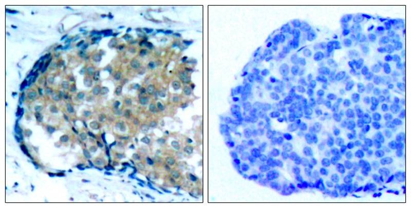 Anti-Phospho-Ezrin (Tyr353) Polyclonal Antibody