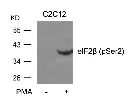 Anti-Phospho-eIF2B (Ser2) Polyclonal Antibody