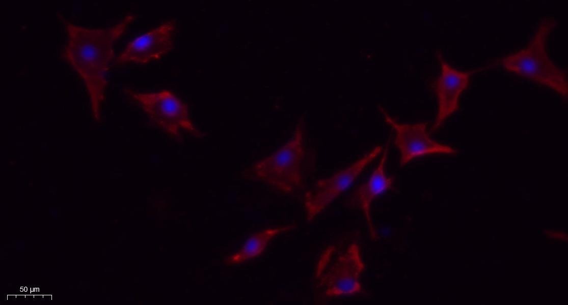 Anti-Phospho-eNOS (Ser1177) Polyclonal Antibody 2