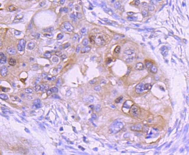 Anti-Ezrin Antibody (7A973)