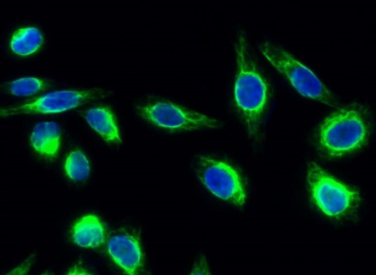 Anti-Phospho-eNOS (Ser1177) Polyclonal Antibody 2