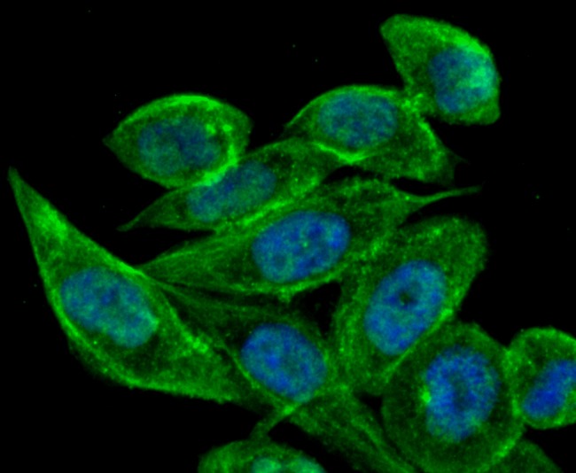 Anti-TFF1 Antibody (6D947)