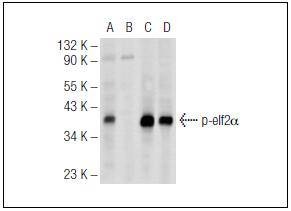 Anti-Phospho-EIF2S1 (Ser 52) Polyclonal Antibody