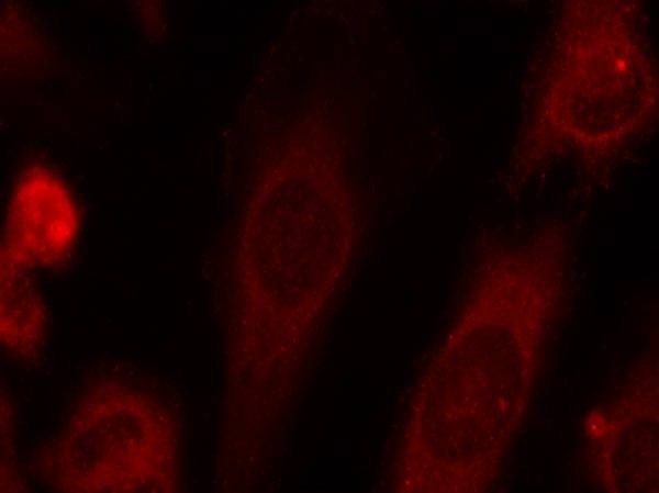 Anti-Phospho-EIF2S1 (Ser51) Polyclonal Antibody 2