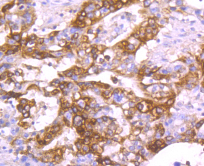 Anti-TFF1 Antibody (6D947)