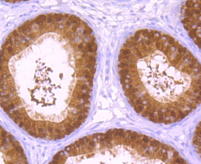 Anti-Exportin-5 Antibody (6J749)