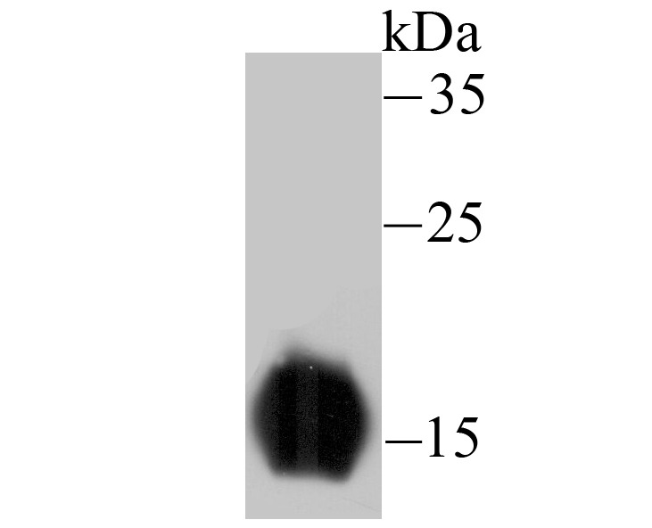 Anti-FABP3 Antibody (7G722)