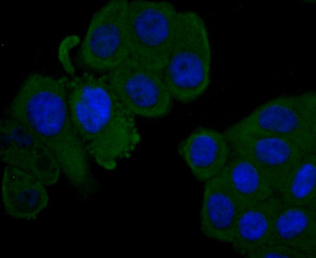 Anti-Complement factor H/CFH Antibody (2X509)