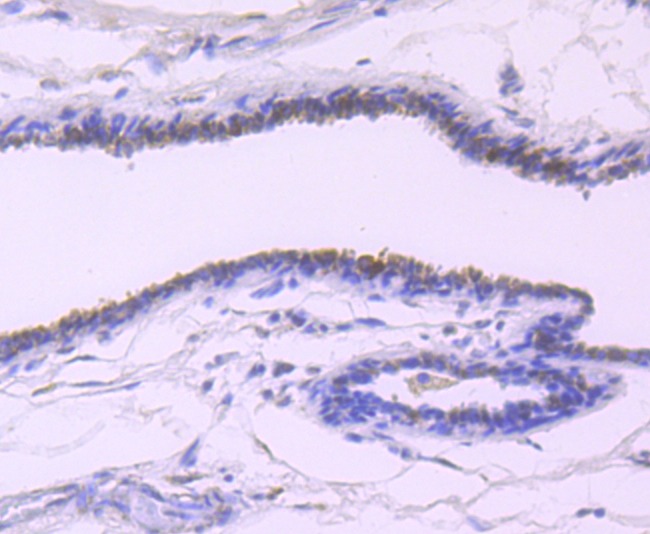 Anti-TFF1 Antibody (6D947)