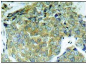 Anti-Phospho-EIF2S1 (Ser 52) Polyclonal Antibody