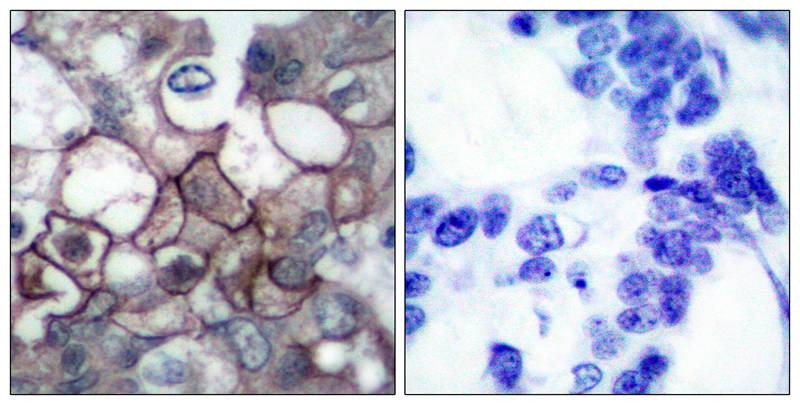 Anti-Phospho-EGFR (Tyr1197) Polyclonal Antibody