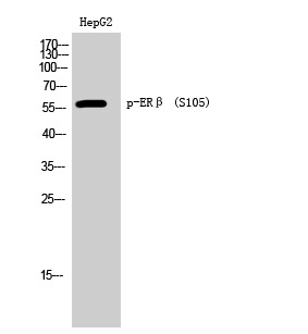 Anti-Phospho-ER beta (Ser105) Polyclonal Antibody