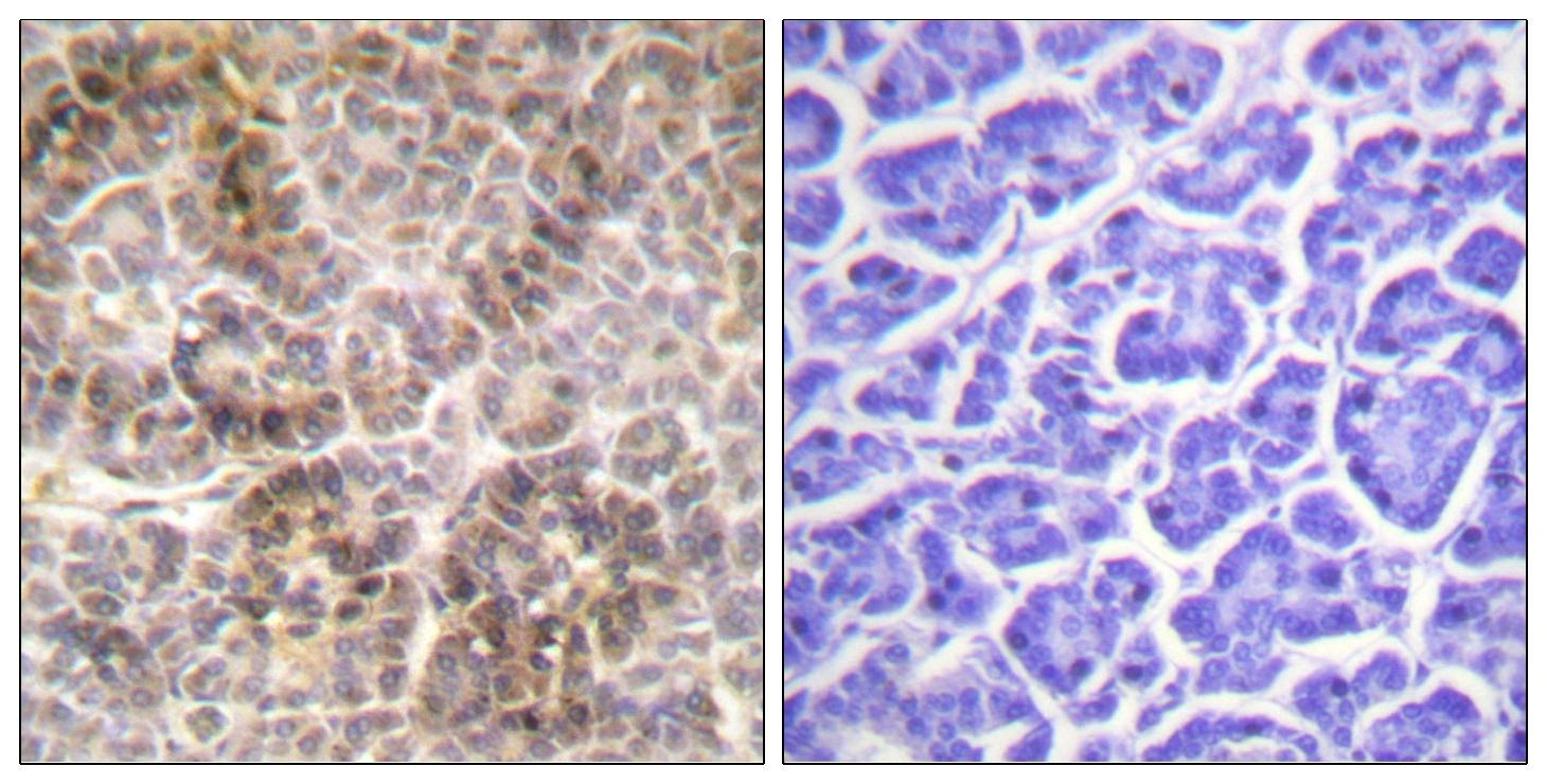 Anti-Phospho-Ezrin/Radixin/Moesin (Thr567/564/558) Polyclonal Antibody