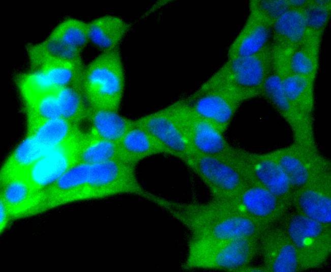 Anti-ERK5 Antibody (5E286)