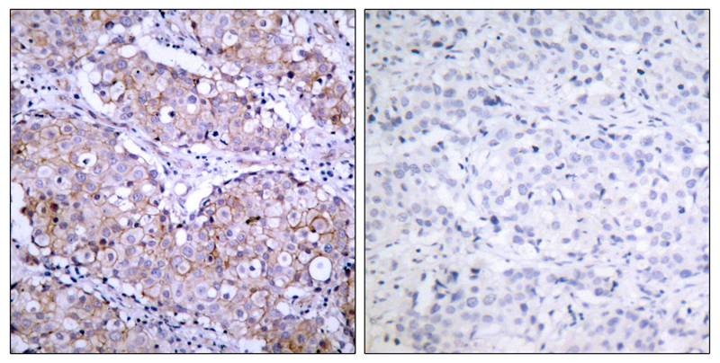 Anti-Phospho-EGFR (Ser1070) Polyclonal Antibody
