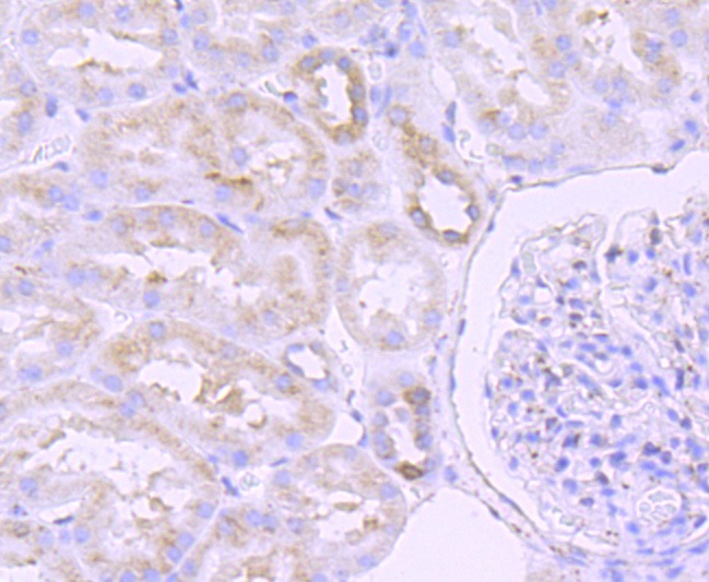 Anti-PDIA3 Antibody (8V206)