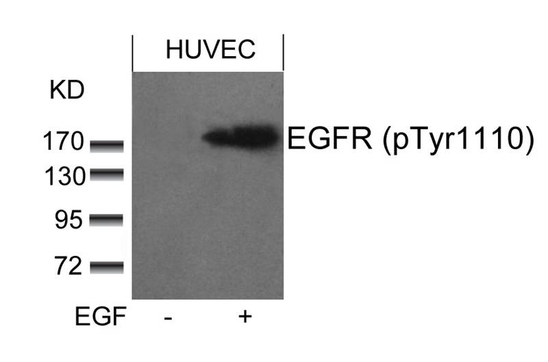 Anti-Phospho-EGFR (Tyr1110) Polyclonal Antibody